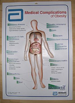 3D Embossed Wall Medical Chart/Poster